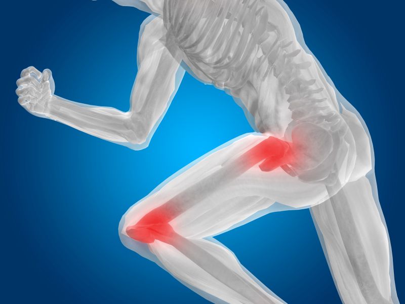 What Causes Knee Pain After Hip Replacement Surgery
