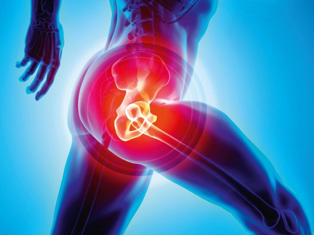 Why Does Knee Pain Occur After Hip Replacement Surgery?