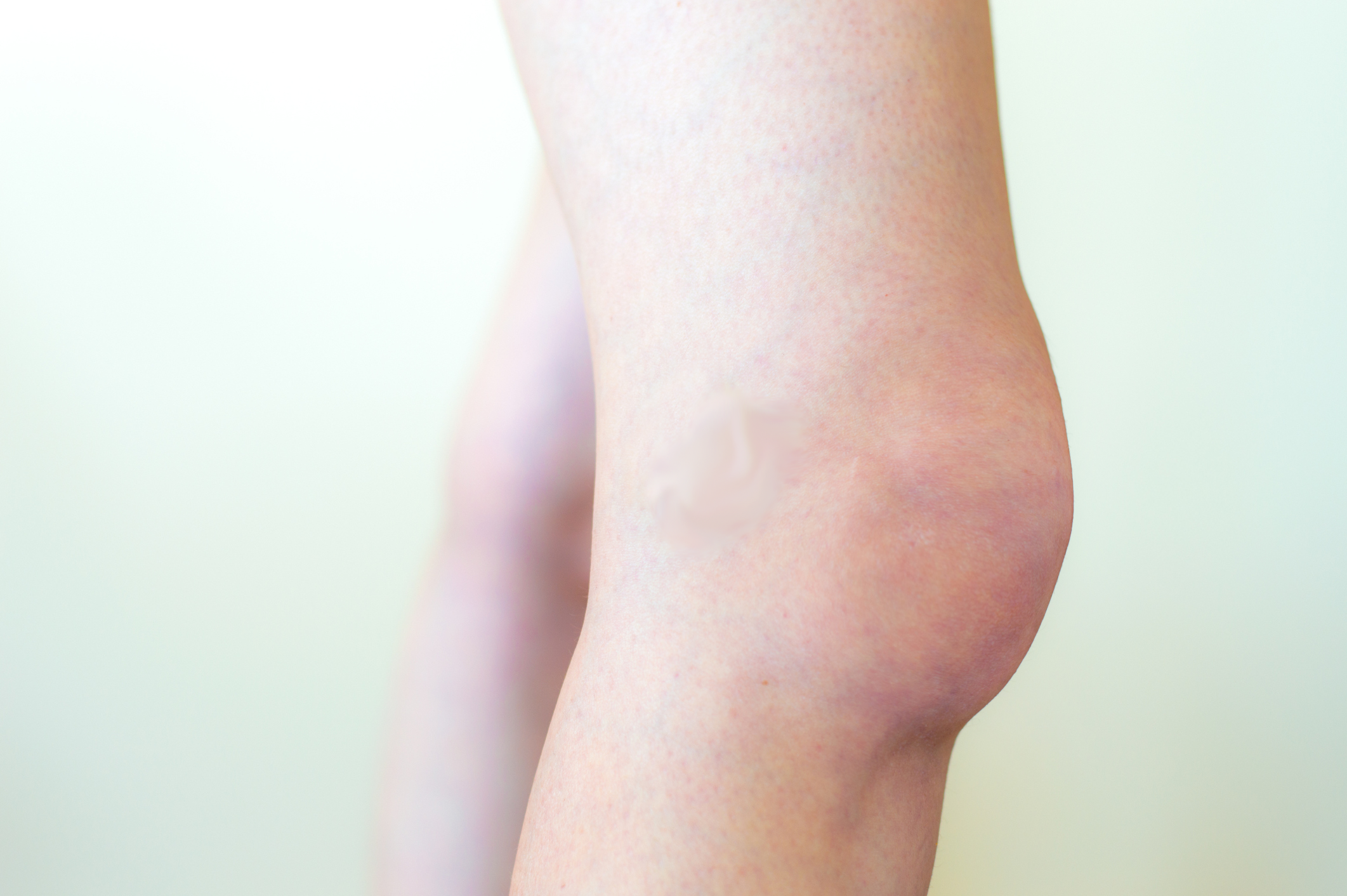 Can A Swollen Knee Be Dangerous